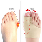 Toe Separator with Alignment Support