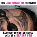 AstraGlow Pocket Laser Pen Freckles Tattoos And Moles