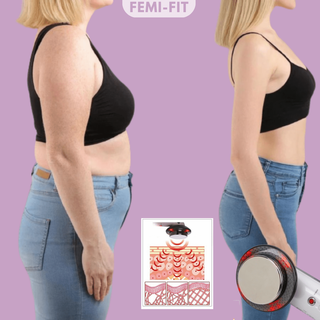 3-in-1 Cellulite and Fat Burner with EMS, Ultrasound & Infrared - Fioriscas