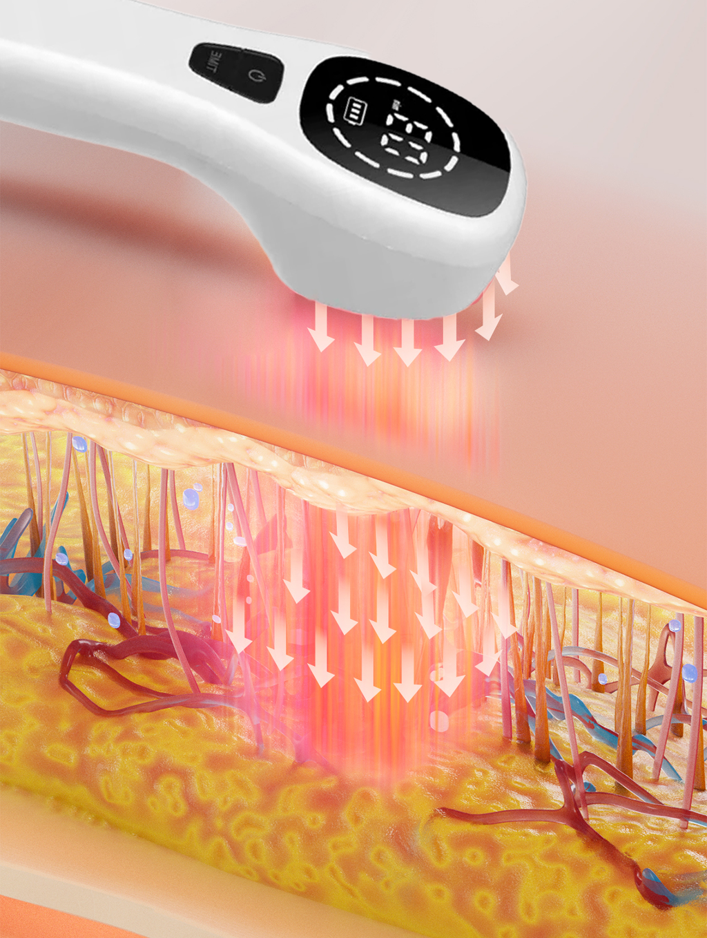 Soulagement des douleurs à domicile avec appareil laser froid à double longueur d’onde amélioré | Fioriscas