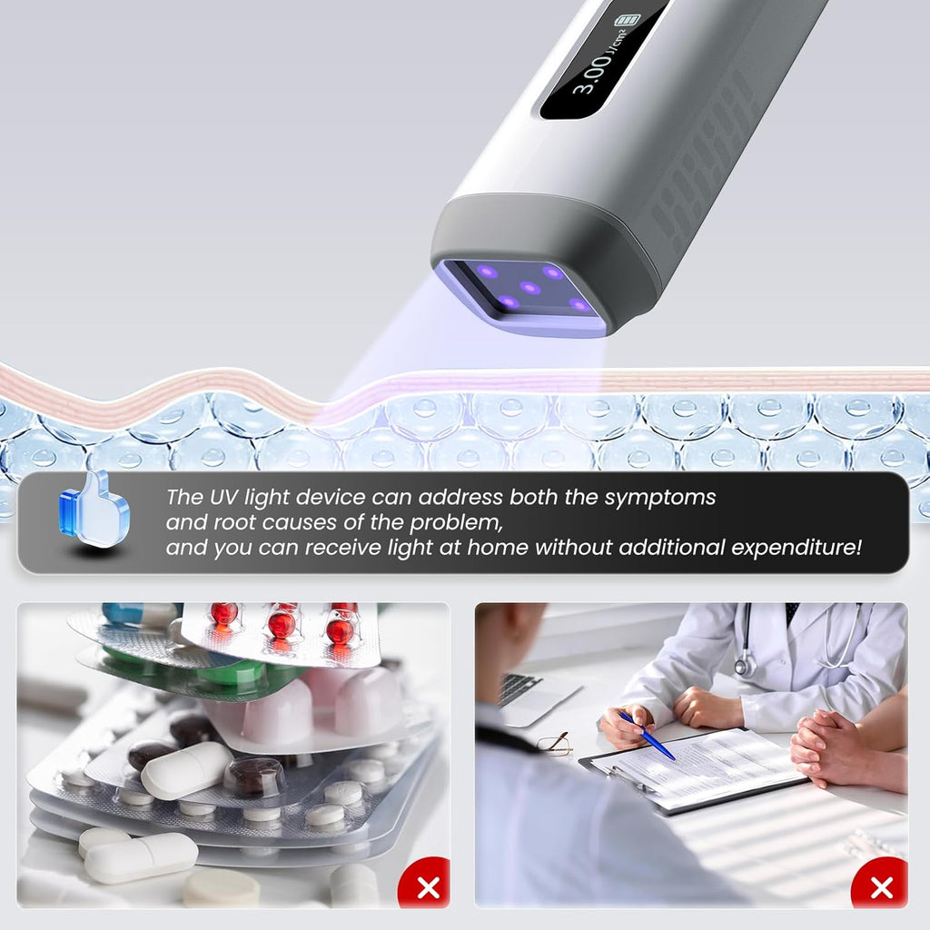 Handheld UVB Light 308nm Device For Home Use Skin Care