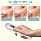 Handheld UVB Light 308nm Device For Home Use Skin Care