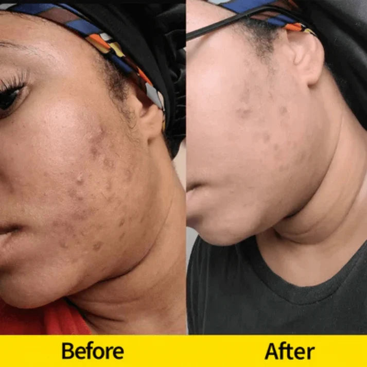 Turmeric & Kojic Acid Cleansing Bar for Face & Body | Fioriscas