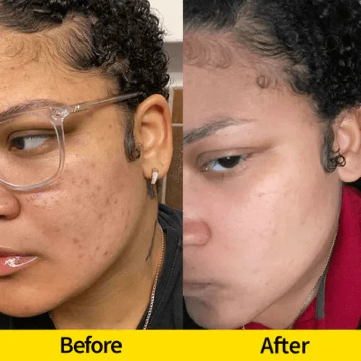Turmeric & Kojic Acid Cleansing Bar for Face & Body | Fioriscas