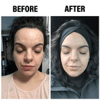Turmeric & Kojic Acid Cleansing Bar for Face & Body | Fioriscas