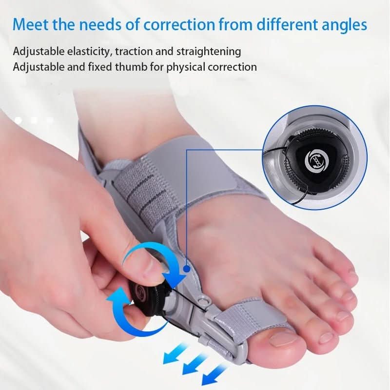 Corecție delicată a degetului pentru hallux valgus - Fioriscas