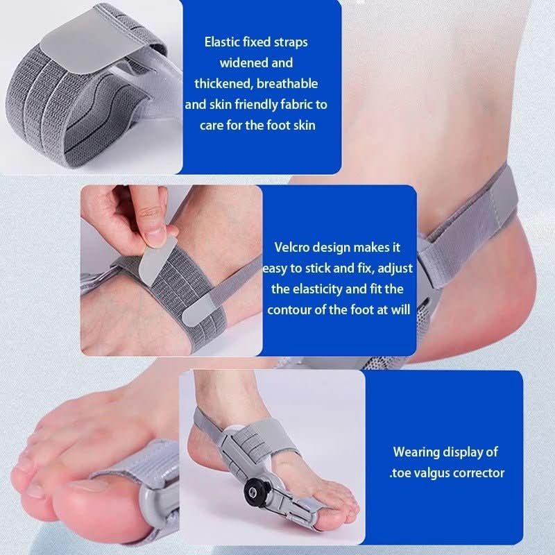 Corecție delicată a degetului pentru hallux valgus - Fioriscas