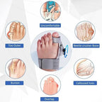 Corecție delicată a degetului pentru hallux valgus - Fioriscas