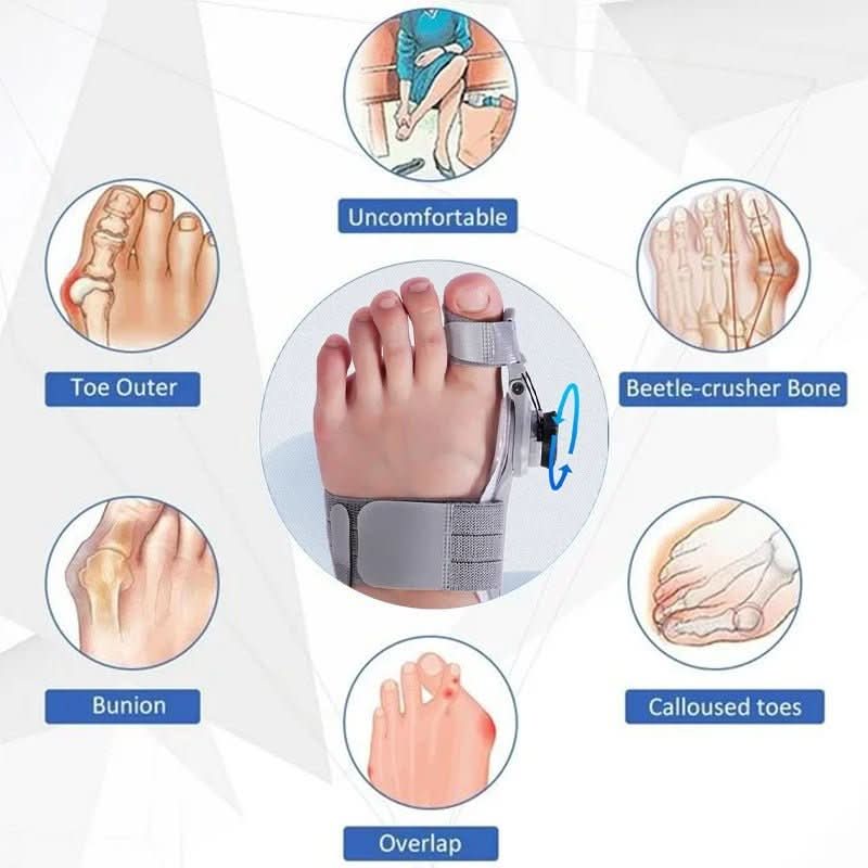 Corecție delicată a degetului pentru hallux valgus - Fioriscas