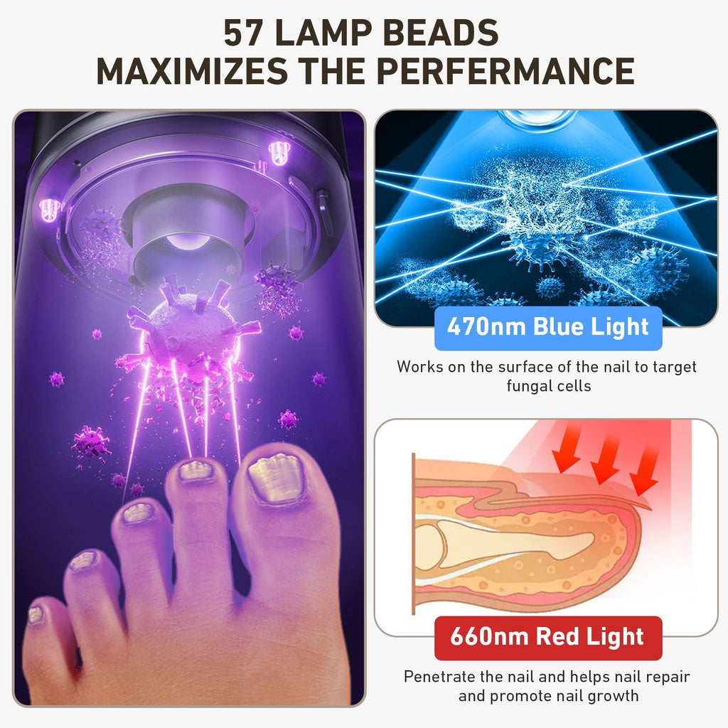 Nail Renewal Light-enhed – Blåt og rødt lys terapi for sundere, klarere negle | Fioriscas