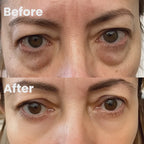 LumaNova Eye Rejuvenator – mikroproudové ošetření a terapie červeným světlem