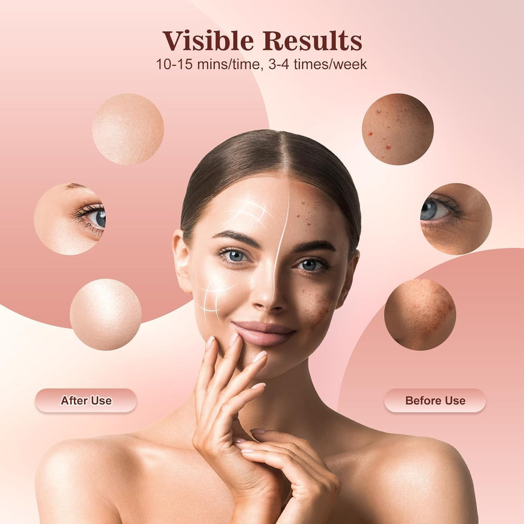 Glow Ritual – Freihändige LED-Lichttherapiemaske für strahlende, gesund aussehende Haut | Fioriscas