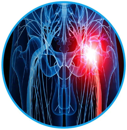 Sciatica Relief Belt for Back & Hip Pain |