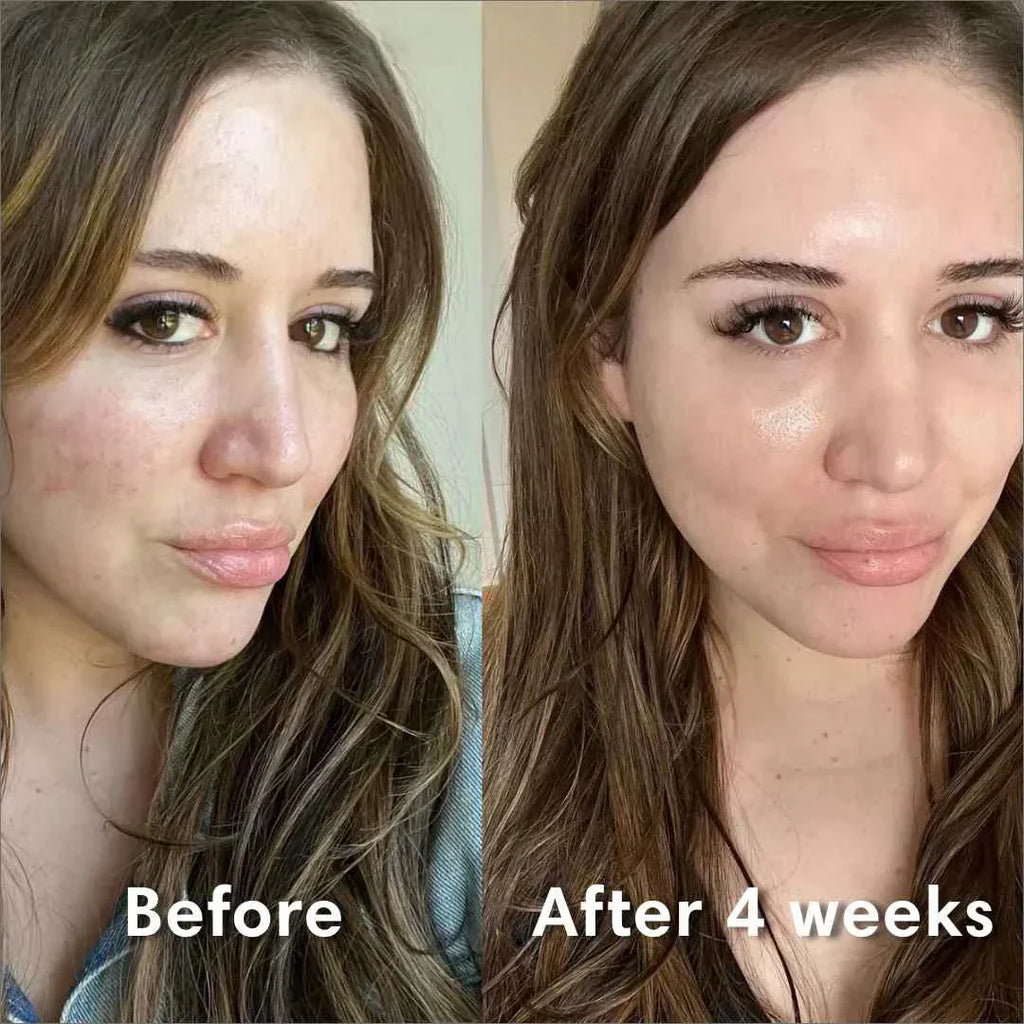 Bio-Collagen Hydrating Sheet Mask By Aurelia Glow For Glowing Skin