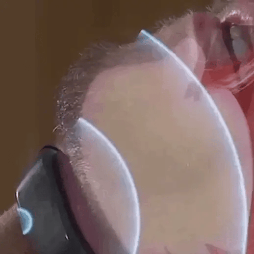 לומהוויספר עזר שינה נגד נחירות, נייד USB לנוחות לשינה שקטה יותר
