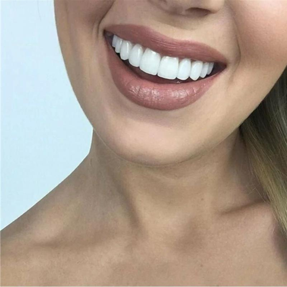 Cosmetische glimlachbedekking, herbruikbare flexibele gebitsset op maat