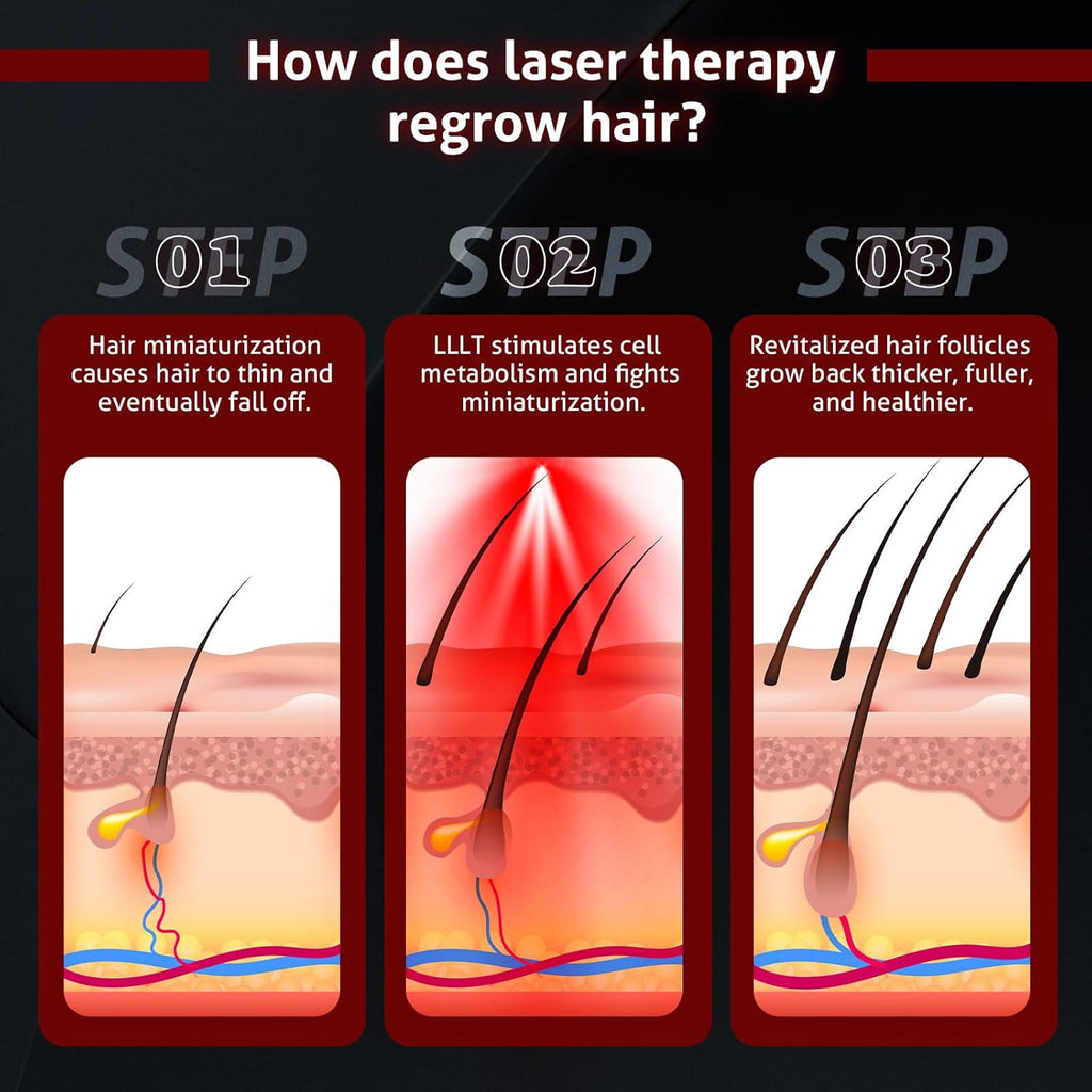 Cască laser fără fir pentru regenerarea părului – terapie cu lumină roșie | Fioriscas
