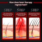 Cască laser fără fir pentru regenerarea părului – terapie cu lumină roșie | Fioriscas