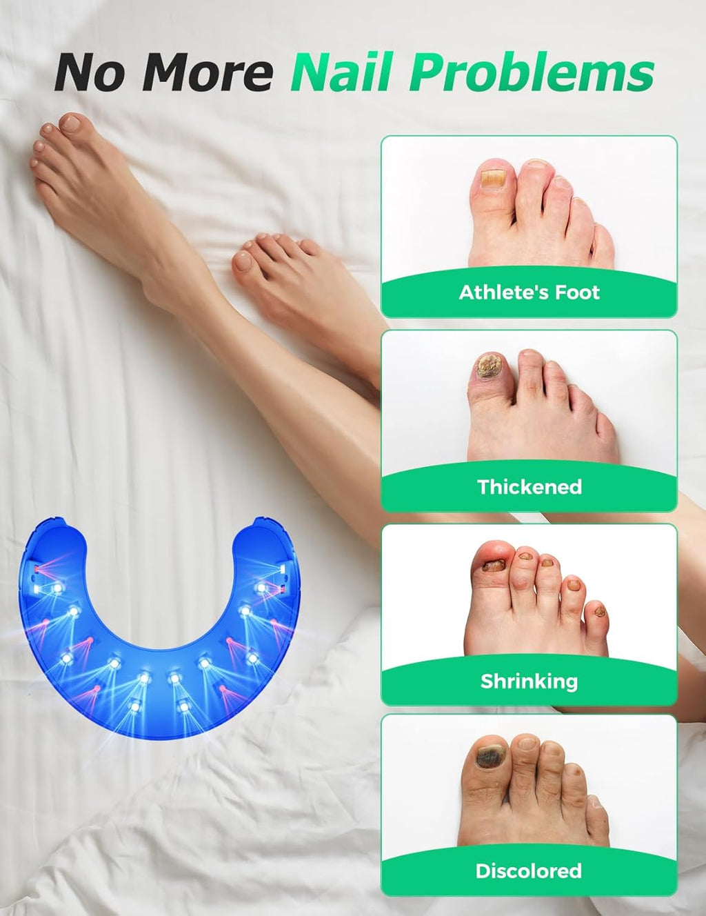 Dispositivo wireless per fototerapia a doppia luce contro l’alterazione del colore delle unghie e per il benessere quotidiano | Fioriscas