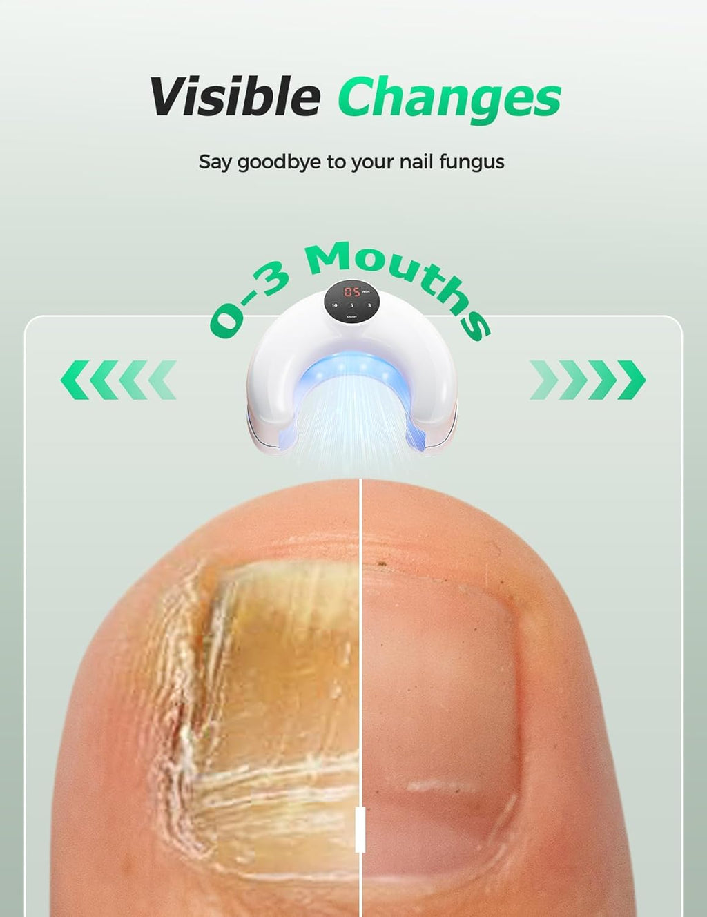 Dispositivo wireless per fototerapia a doppia luce contro l’alterazione del colore delle unghie e per il benessere quotidiano | Fioriscas